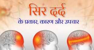 Sir dard