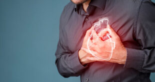 Heart attack