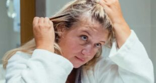 बार बार क्यों लौट आता है डैंड्रफ? क्या इसे हमेशा के लिए खत्म करना नामुमकिन है; जानिए डर्मेटोलॉजिस्ट से इसके पीछे का मेडिकल साइंस और रूसी को काबू में रखने का सही तरीका