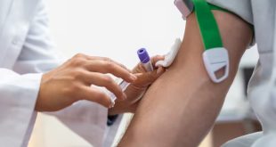 क्या आपकी KFT रिपोर्ट में Sodium लेवल 145 mEq/L से ज्यादा