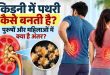 Kidney Stones Symptoms and Causes: किडनी में पथरी बनने की असली वजह क्या है, क्या पुरुषों से ज्यादा महिलाओं में बढ़ रहा है स्टोन का खतरा?